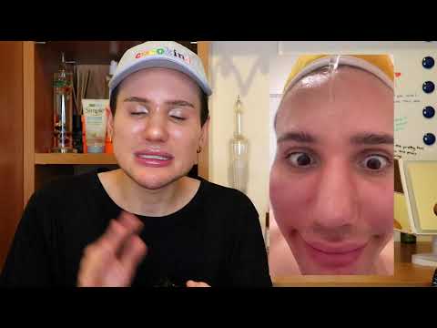 acne scars - acne scars