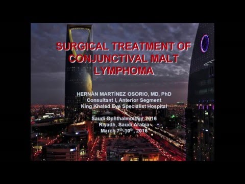 SURGICAL TREATMENT OF CONJUNCTIVAL MALT LYMPHOMA