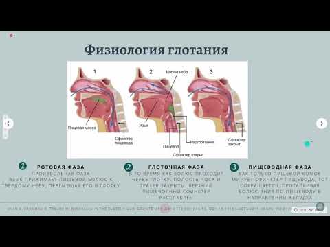 Дисфагия. Причины и классификация.