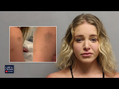 Photos of bruises may aid onlyfans model courtney clenney’s self-defense claim