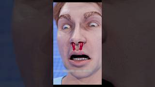Why Does Blood Come Out Of The Nose? 😱 Resimi