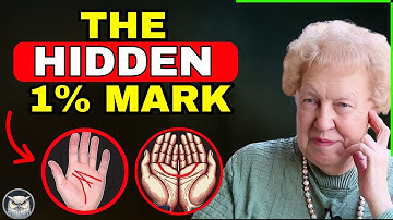If You Have BOTH Marks, You’re Part of the Hidden Angelic 1% (The Proof Is Unmistakable)