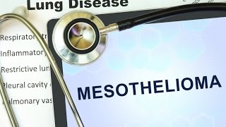 How to Claim Compensation for Mesothelioma