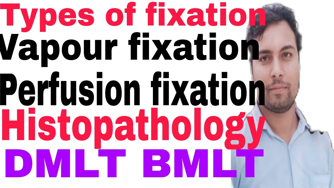 Types of fixation vapour fixation perfusion fixation