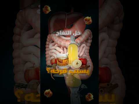خل التفاح يسبب قرحة المعدة حقيقة ام خرافة  خل التفاح قرحة المعدة