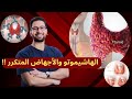 الحلقة ٢ اثر الهاشيموتو على الحمل وعلاقتهم بالاجهاض المبكر الاعراض وطرق الوقاية منها 