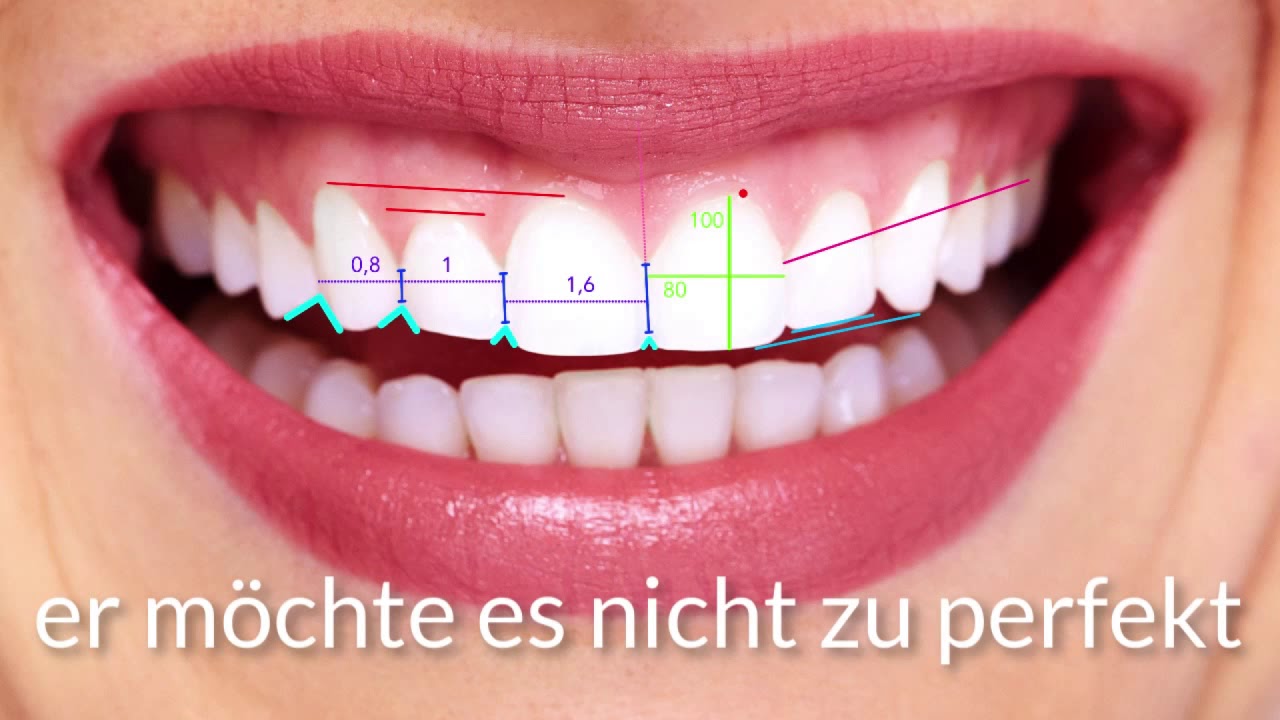 ihr lächeln ist unsere visitkarte - veneers