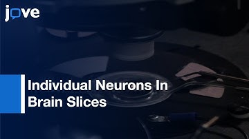 Voltage-Sensitive Dye Recording From Axons, Dendrites & Dendritic Spines l Protocol Preview