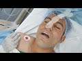 Man Falls to sleep in 30 Seconds - Quick Anesthesia
