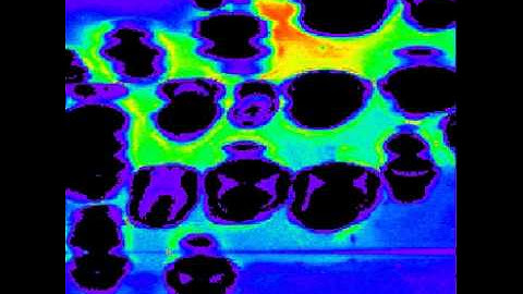 Stable and Inertial Cavitation