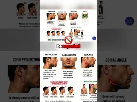 Can You Fix The Ramus Naturally? #bp #jawline #mewing #looks #looksmaxxing