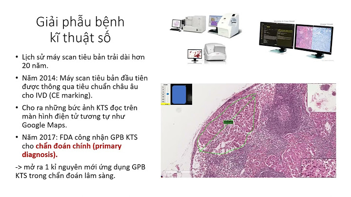 Giá trị cytokeratin ck trong giải phẫu bệnh là gì năm 2024