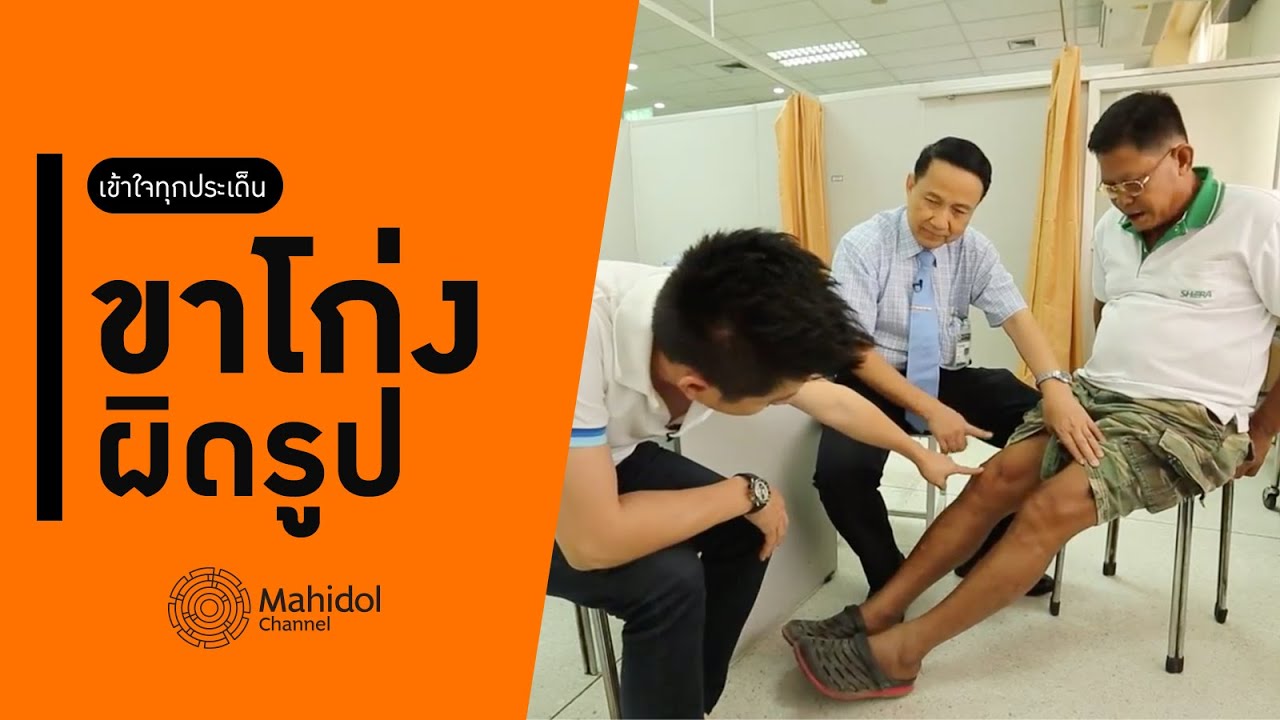 ขาโก่งผิดรูป ขาบวม ปวดขา เดินไม่ได้ เข้าใจทุกประเด็นในคลิปนี้ [หาหมอ by Mahidol Channel]