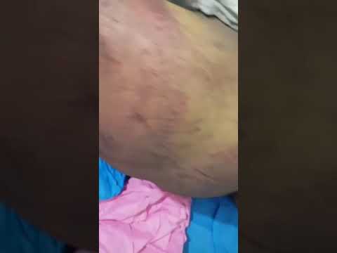 شکنجه یک جوان بلوچ توسط مامورین اداره اطلاعات