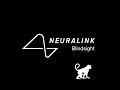 NEURALINK PROBADO YA EN EL PRIMER SER HUMANO!!! LO CAMBIARA TODO!