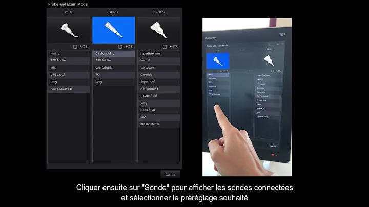 Mindray TE7 Prise en main--FR