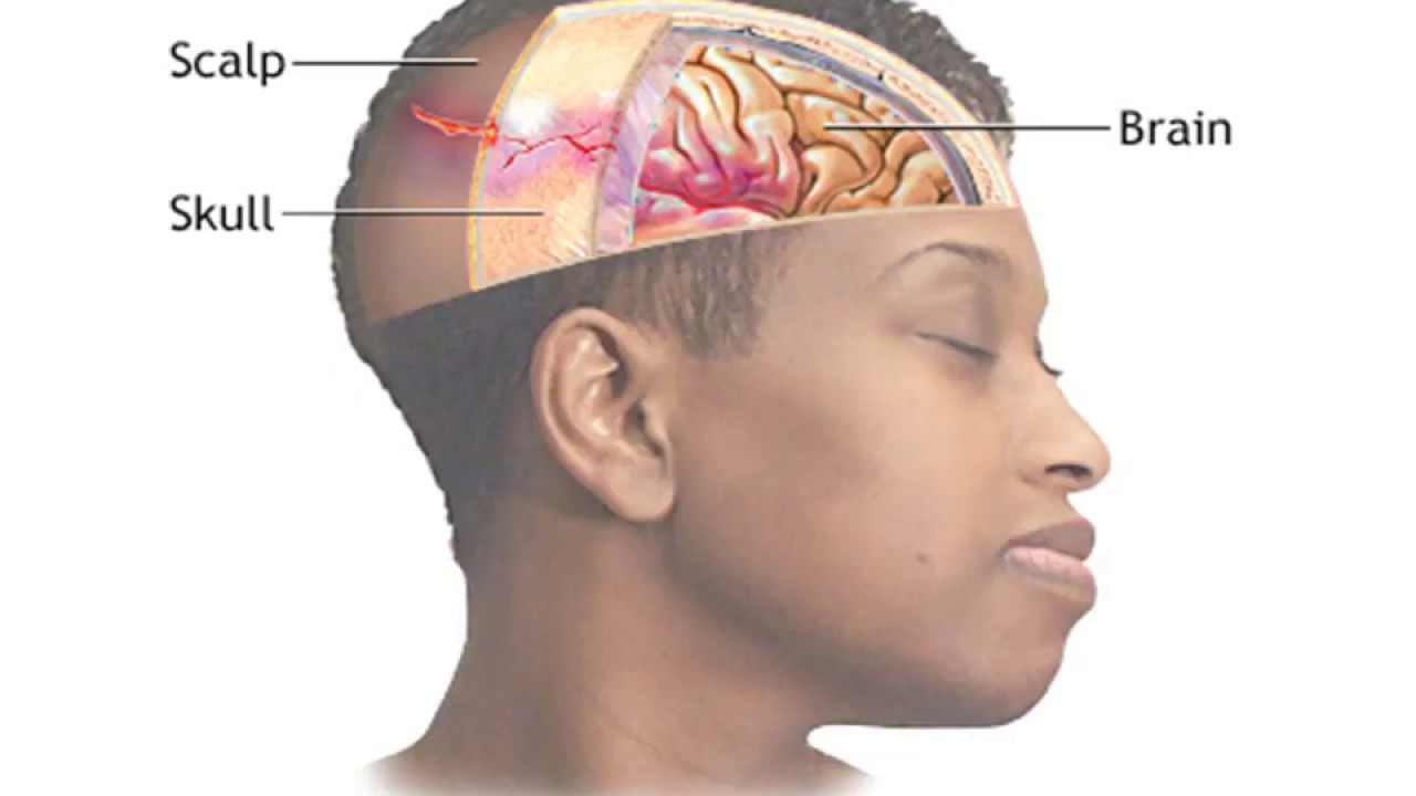 Индейцы америки скальпирование. Скальп это. Скальп это. Скальп это. Очаговая алопеция (alopecia areata).