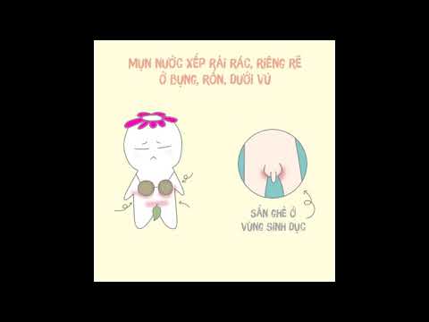 Video Bệnh Ghẻ (Cái Ghẻ) - Triệu chứng và điều trị - youtube