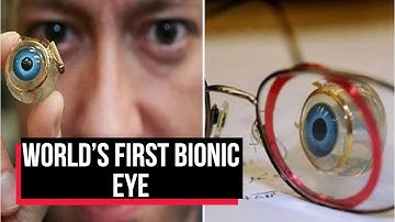 World’s first bionic eye to fully restore vision in blind people | Cobrapost