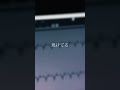 圧倒的なアイラブユー