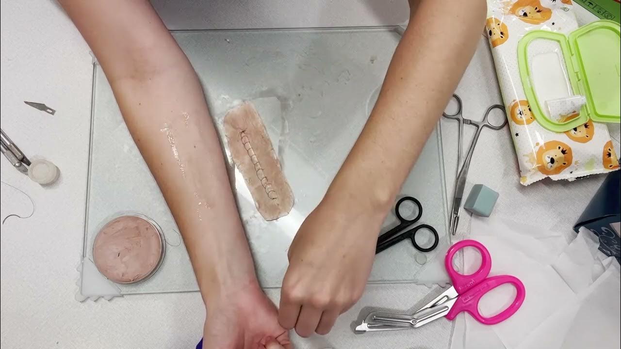 Infected sutures YouTube