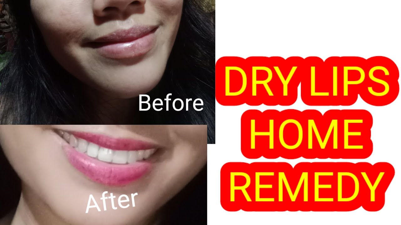 Home Remedy Dry Lips 💋 YouTube
