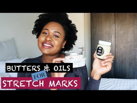STRETCH MARK CREAMS THAT WORK! - ___