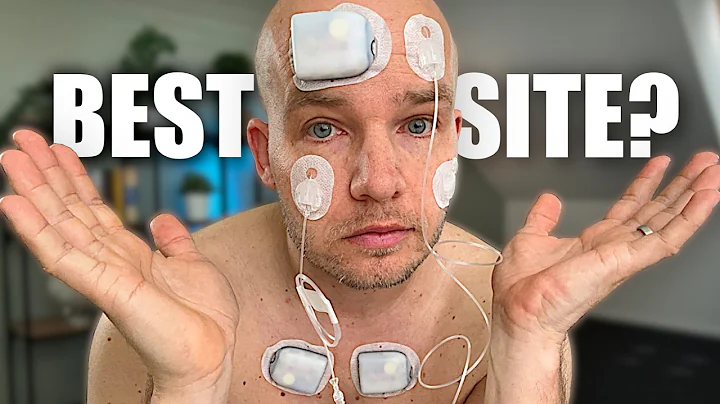 My Secret Insulin Pump Sites Revealed