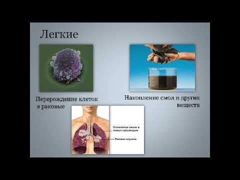 Влияние курения на органы дыхания (Марчюнас ОП215)