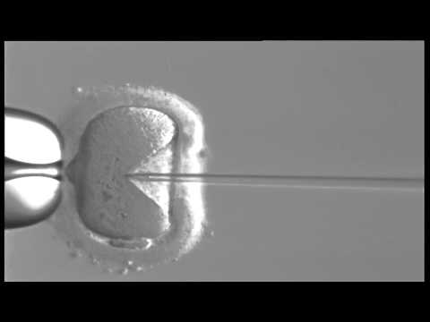 Video: Kašnjenje Okidača Sazrijevanja Oocita Za Jedan Dan Dovodi Do Većeg Prinosa Oocita Metafaze II U IVF / ICSI: Randomizirano Kontrolirano Ispitivanje