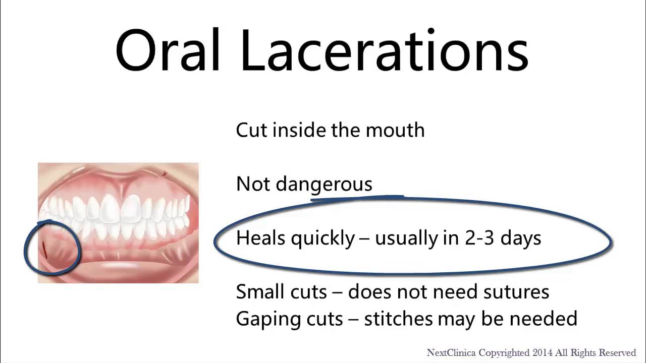 intra-oral-laceration-youtube