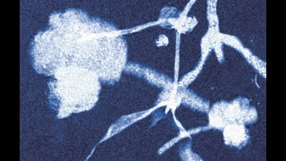 Download Lagu Hoe ga je om met een eetstoornis? MP3