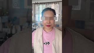 측두이미지거상