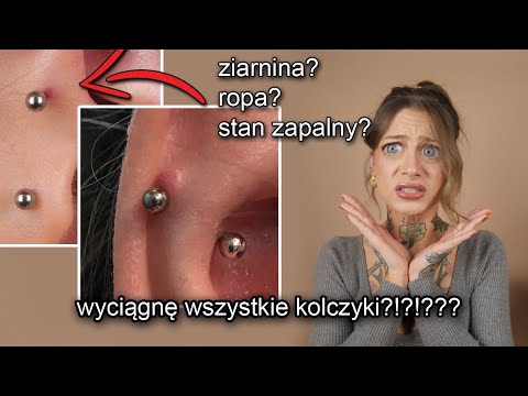 Wideo: 3 sposoby leczenia zarażonego przekłucia nosa