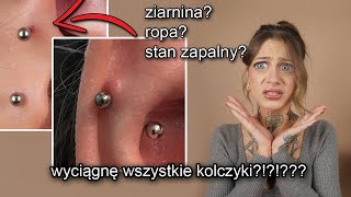 POPSUŁAM SOBIE PIERCING???? ~ WSZYSTKO O MOIM NOWYM PIERCINGU