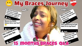 🦷😍15 Months complete With Braces || Q\u0026A On Braces Cost pain Duration \u0026 Face looks All your Questions