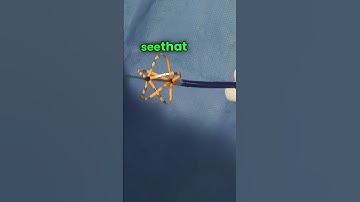 FARAPULSE PFA System with FARAWAVE PFA Catheter