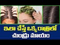 How to Get Rid of Dandruff || dandruff treatment at home in telugu || Beauty tips #StopDandruff