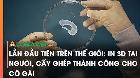 Lần đầu tiên trên thế giới: In 3D tai người, cấy ghép thành công cho cô gái