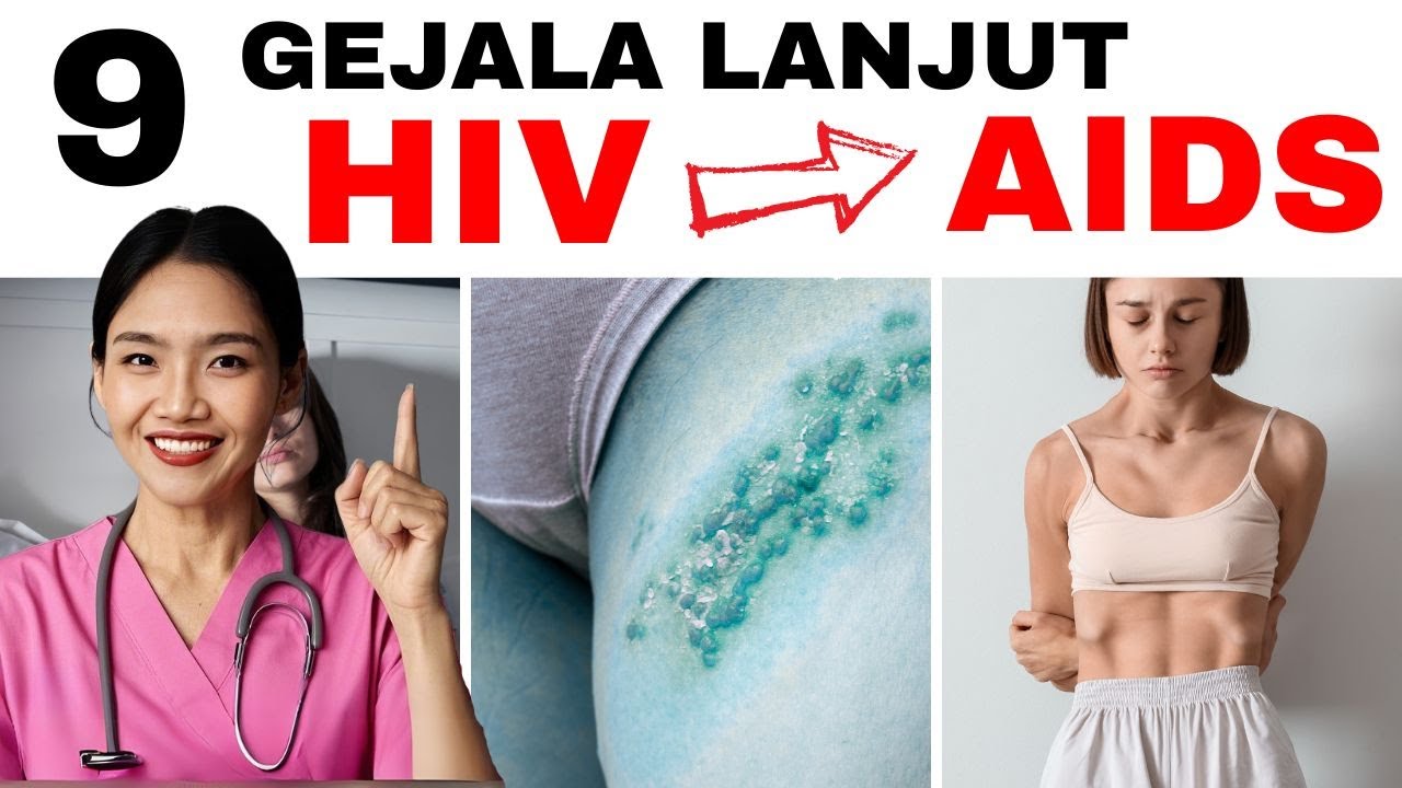 9 симптомов ВИЧ от хронической латентной формы до СПИДа: признаки, которые часто пропускают