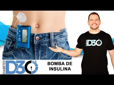 Vídeo: Bombas De Insulina Para Pessoas Com Diabetes