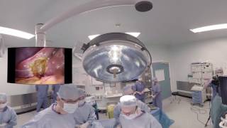 Laparoscopic Cholecystectomy 360 Video - Professor Arnie Hill