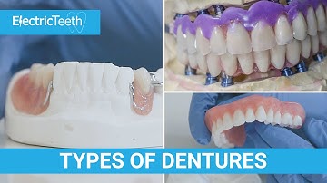 Type of dentures & false teeth