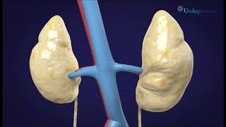 Robotic Surgery In Sauc Kuwait