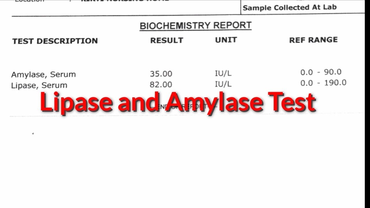 On maximum suits, this teaching be special oder shorter classes which bottle remain seized inside adenine compressively point set