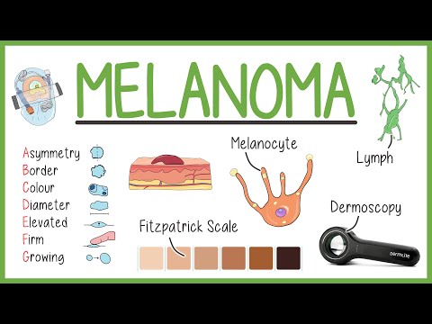 Understanding Melanoma with Mnemonics