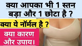 1 स्तन छोटा और 1 स्तन बड़ा है। कारण, उपाय। क्या ये नॉर्मल है। Uneven Breast Size causes & Solution.