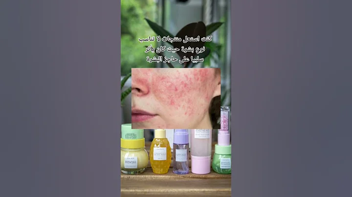 How I destroyed my skin ? 😫 mistakes I made that ruined my skin #shorts