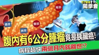 25歲少女「腹內有6公分腫瘤」竟是胰臟癌!? 病程超快「兩個月內就離世」醫師:健檢難發現!【 @57healthy 】#陳榮堅 醫師
