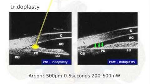Plateau Iris Lecture by Gus Gazzard